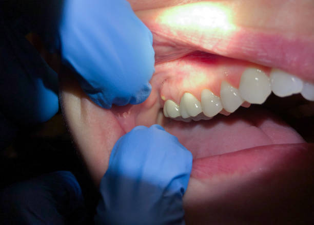Best Weekend Emergency Dentist in Tuckerman, AR