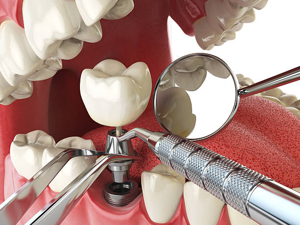 Best Emergency Dental Surgery in Tuckerman, AR